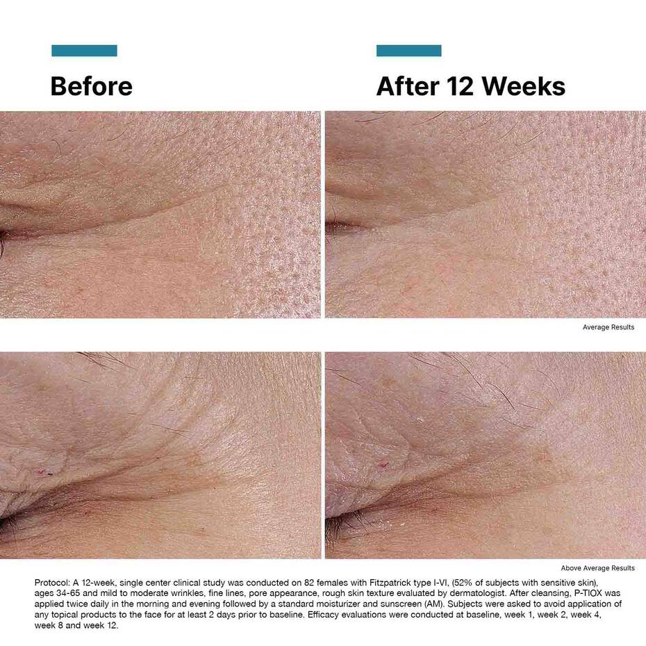 SkinCeuticals P-TIOX Anti-Wrinkle Peptide Serum (1 fl. oz.)